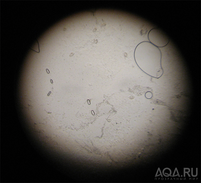 Микроскопирование соскоба со скалярии 2